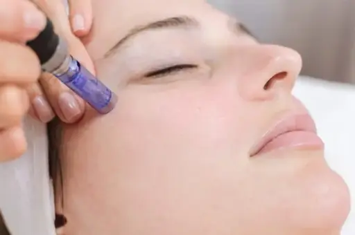 Limpieza Facial con Punta de Diamante (40min)