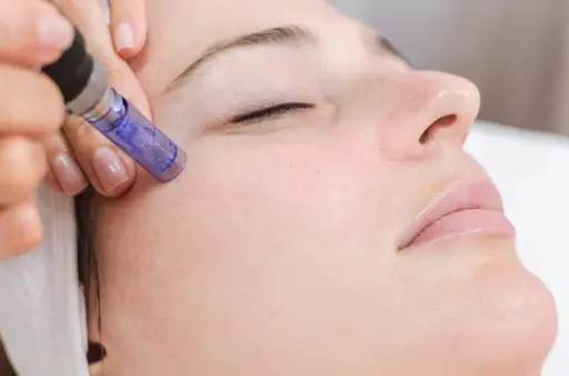 Dermapen — Skin Glow con Vitaminas  (40 min)  